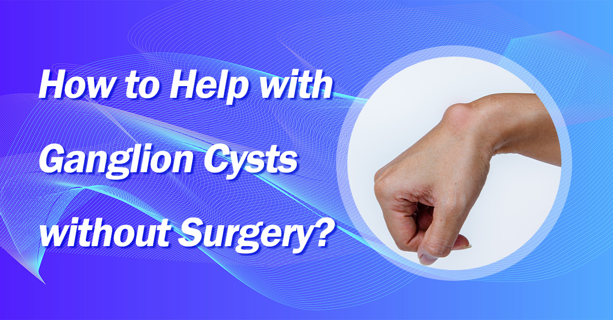 How To Cure Ganglion Cyst Without Surgery Robert Lopez Kapsels Reverasite